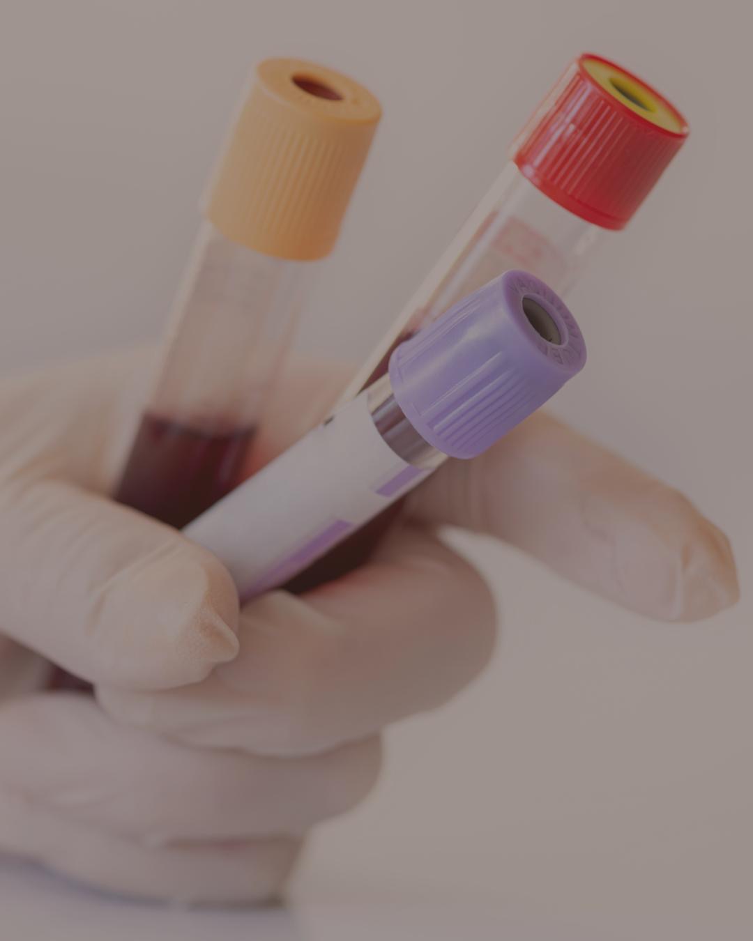 PRP & PRF Therapy